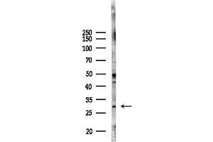 Western blot analysis of lysates from 293 cells(UV 30 min treatment), using KCNIP2 Antibody at 1/1000 dilution.