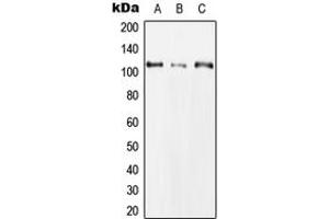Western blot analysis of CLCN1 expression in Hela (A), NIH3T3 (B), H9C2 (C) whole cell lysates. (CLCN1 antibody  (N-Term))