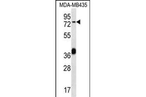 CEL Antibody (Center) (ABIN656486 and ABIN2837867) western blot analysis in MDA-M cell line lysates (35 μg/lane). (Cholesterol Esterase antibody  (AA 454-482))