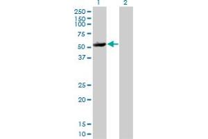 Western Blot analysis of MAPKAPK5 expression in transfected 293T cell line by MAPKAPK5 monoclonal antibody (M01), clone 2D5.