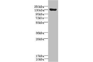 Western blot All lanes: SCN8A antibody IgG at 1. (SCN8A antibody  (AA 1350-1440))