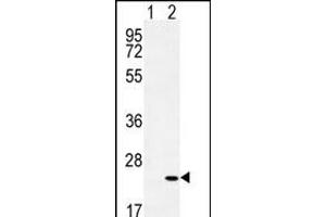 Western blot analysis of CRH (arrow) using rabbit polyclonal CRH Antibody (C-term) (ABIN655191 and ABIN2844807).