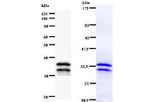 Left: NR4A1staining. (NR4A1 antibody)