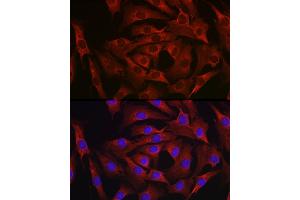 Immunofluorescence analysis of NIH-3T3 cells using MARCKS Rabbit pAb (ABIN6134393, ABIN6143555, ABIN6143556 and ABIN6214033) at dilution of 1:100 (40x lens). (MARCKS antibody  (AA 1-100))