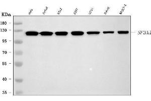 Western blot analysis of SF3A1 using anti-SF3A1 antibody (ABIN7600556). (SF3A1 antibody  (AA 20-556))