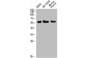 Western Blot analysis of K562 SH-SY5Y mouse-brain cells using E-Selectin Polyclonal Antibody diluted at 1:500. (Selectin E/CD62e antibody)