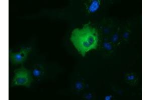 Anti-DYNC1LI1 mouse monoclonal antibody (ABIN2452965) immunofluorescent staining of COS7 cells transiently transfected by pCMV6-ENTRY DYNC1LI1 (RC222010). (DYNC1LI1 antibody)