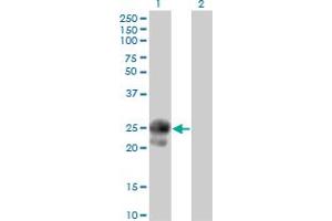 Western Blot analysis of BAMBI expression in transfected 293T cell line by BAMBI monoclonal antibody (M01), clone 3C1-1D1. (BAMBI antibody  (AA 1-260))