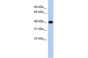 WB Suggested Anti-KIAA1189 Antibody Titration: 0. (ERMN antibody  (Middle Region))