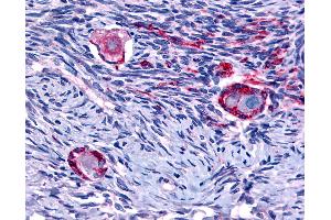 Immunohistochemistry (IHC) image for anti-Nuclear Receptor Subfamily 4, Group A, Member 1 (NR4A1) (N-Term) antibody (ABIN1049160)