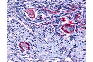 Anti-NUR77 antibody IHC of human ovary.