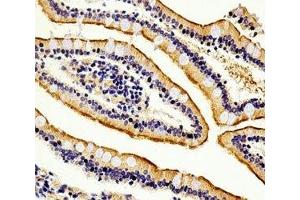Immunohistochemical analysis of paraffin-embedded human small intestine section using anti-Alkaline Phosphatase antibody diluted at 1:100 dilution. (Alkaline Phosphatase antibody  (AA 274-304))
