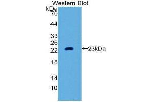 Western Blotting (WB) image for anti-Matrix Metallopeptidase 3 (Stromelysin 1, Progelatinase) (MMP3) (AA 289-452) antibody (ABIN1859854) (MMP3 antibody  (AA 289-452))