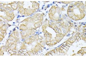 Immunohistochemistry of paraffin-embedded Human stomach using SPTAN1 Polyclonal Antibody at dilution of 1:100 (40x lens). (SPTAN1 antibody)