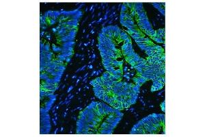 IF analysis of Cytokeratin 8 using anti-Cytokeratin 8 antibody (ABIN6719478). (KRT8 antibody  (AA 107-325))