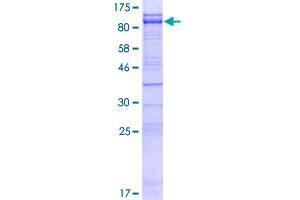 Image no. 1 for Centrosomal Protein 76kDa (Cep76) (AA 1-659) protein (GST tag) (ABIN1349159) (Cep76 Protein (AA 1-659) (GST tag))
