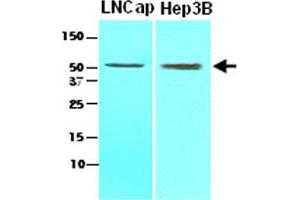 Cell lysates of LNCap (lane 1), Hep3B (lane 2) (30 ug) were resolved by SDS-PAGE, transferred to NC membrane and probed with ACOT11 monoclonal antibody, clone J4B2  (1:1000).