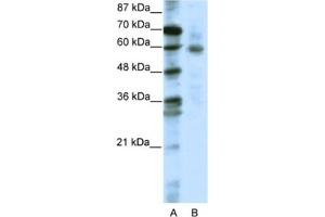 Western Blotting (WB) image for anti-Forkhead Box O1 (FOXO1) antibody (ABIN2461644) (FOXO1 antibody)
