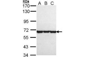 TCP1 theta Antibody staining of A431 (A), H1299 (B), HeLa (C) whole cell lysates (30 µg) at 1/1000 dilution, 7. (CCT8 antibody  (AA 111-327))