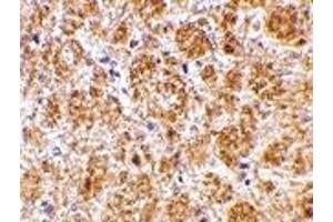 Immunohistochemistry (IHC) image for anti-Duffy Blood Group, Chemokine Receptor (DARC) (C-Term) antibody (ABIN1030355)