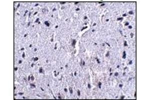 Immunohistochemistry (IHC) image for anti-Programmed Cell Death 1 (PDCD1) antibody (ABIN492541) (PD-1 antibody)