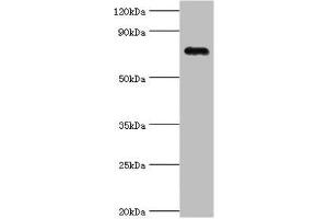 Western blot All lanes: Cartilage oligomeric matrix protein antibody at 4 μg/mL + Mouse skeletal muscle tissue Secondary Goat polyclonal to rabbit IgG at 1/10000 dilution Predicted band size: 83, 78 kDa Observed band size: 83 kDa