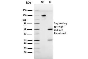SDS-PAGE Analysis Purified Estrogen Receptor alpha Mouse Monoclonal Antibody (ESR1/3557). (Estrogen Receptor alpha antibody  (AA 129-312))