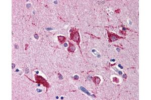 anti-Ras Homolog Enriched in Brain (RHEB) antibody