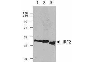 Western Blotting (WB) image for anti-Interferon Regulatory Factor 2 (IRF2) antibody (ABIN2665203) (IRF2 antibody)