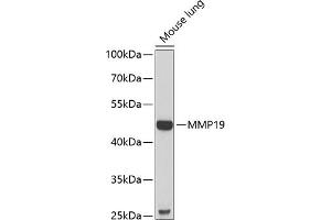Western blot analysis of extracts of mouse lung, using MMP19 antibody (ABIN6132357, ABIN6143908, ABIN6143909 and ABIN6222356) at 1:1000 dilution. (MMP19 antibody  (AA 209-508))