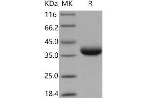 Western Blotting (WB) image for Junctional Adhesion Molecule 2 (JAM2) (Active) protein (His tag) (ABIN7320270)