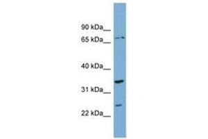 Image no. 1 for anti-Pyruvate Dehyrogenase Phosphatase Catalytic Subunit 2 (PDP2) (AA 287-336) antibody (ABIN6743272) (PDP2 antibody  (AA 287-336))