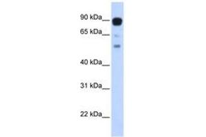 Image no. 1 for anti-Zinc Finger Protein 408 (ZNF408) (AA 648-697) antibody (ABIN6742883) (ZNF408 antibody  (AA 648-697))
