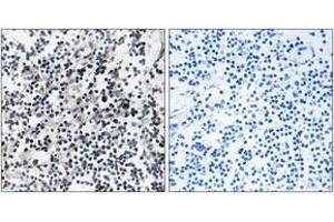 Immunohistochemistry analysis of paraffin-embedded human placenta tissue, using CDC37 (Ab-13) Antibody. (CDC37 antibody  (AA 1-50))