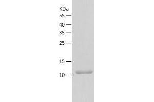 Western Blotting (WB) image for Steroid Receptor RNA Activator 1 (SRA1) (AA 90-236) protein (His tag) (ABIN7125214) (SRA1 Protein (AA 90-236) (His tag))