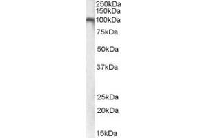 Image no. 1 for anti-Glutamate Receptor, Metabotropic 7 (GRM7) (Internal Region) antibody (ABIN375137) (GRM7 antibody  (Internal Region))