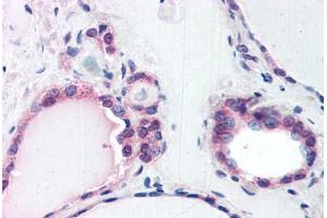 Human Thyroid (formalin-fixed, paraffin-embedded) stained with COPS2 antibody ABIN351473 at 3. (COPS2 antibody  (AA 439-451))