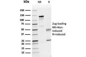 SDS-PAGE Analysis Purified Dystrophin Monospecific Mouse Monoclonal Antibody (DMD/3241).