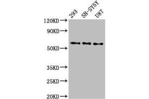 Western Blot Positive WB detected in: 293 whole cell lysate, SH-SY5Y whole cell lysate, U87 whole cell lysate All lanes: SLC11A2 antibody at 3 μg/mL Secondary Goat polyclonal to rabbit IgG at 1/50000 dilution Predicted band size: 63, 62, 65, 66 kDa Observed band size: 63 kDa (SLC11A2 antibody  (AA 1-69))