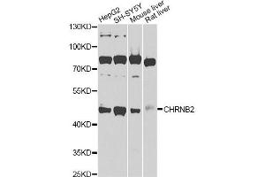 Western blot analysis of extracts of various cell lines, using CHRNB2 Antibody. (CHRNB2 antibody)