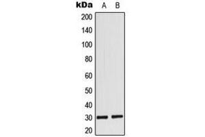 Western blot analysis of MYF6 expression in MCF7 (A), rat heart (B) whole cell lysates. (MYF6 antibody  (Center))