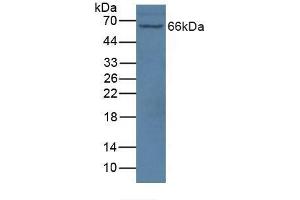 Detection of NOS1AP in Mouse Brain Tissue using Polyclonal Antibody to Nitric Oxide Synthase 1 Adaptor Protein (NOS1AP) (NOS1AP antibody  (AA 285-506))