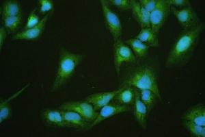 IF analysis of DBI using anti-DBI antibody (ABIN4886558).