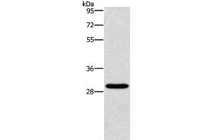 Western Blot analysis of Hela cell using BCL10 Polyclonal Antibody at dilution of 1:950 (BCL10 antibody)