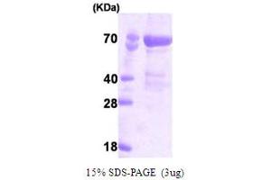 SDS-PAGE (SDS) image for P21-Activated Kinase 4 (PAK4) (AA 1-591) protein (His tag) (ABIN666714) (PAK4 Protein (AA 1-591) (His tag))