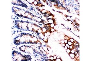 IHC-P: FABP5 antibody testing of rat intestine tissue (FABP5 antibody  (AA 10-23))