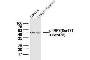 Lane 1: Mouse uterus lysates, Lane 2: Mouse large intestine lysates probed with IRF7 (Ser471 + Ser472) Polyclonal Antibody, unconjugated  at 1:300 overnight at 4°C followed by a conjugated secondary antibody for 60 minutes at 37°C. (IRF7 antibody  (pSer471, pSer472))