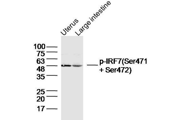 IRF7 antibody  (pSer471, pSer472)