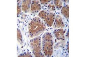 Immunohistochemistry analysis in human stomach tissue (formalin-fixed, paraffin-embedded) using Mid1-interacting protein 1  Antibody  (N-term),  followed by peroxidase conjugation of the secondary antibody and DAB staining. (m1ip1 antibody  (N-Term))