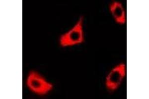 Immunofluorescent analysis of PPOX staining in A549 cells. (PPOX antibody)
